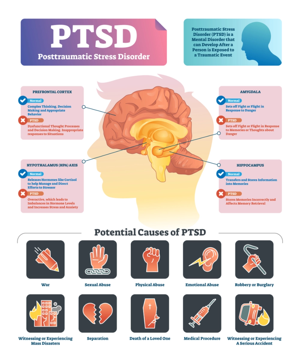 potential causes of PTSD (1)